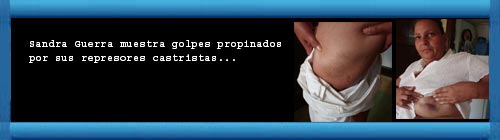 CUBA: Sandra Guerra muestra golpes propinados por sus represores castristas. Por Magaly Norvis Otero Su�rez. Hablemos Press. web/folder.asp?folderID=136 