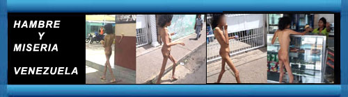 Impactantes imgenes: venezolana desnuda y desnutrida deambula por las calles de Cantaura. Parece una mujer salida de un campo de concentracin. cubademocraciayvida.org web/folder.asp?folderID=136 