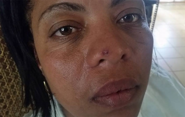 Jaquelinetorturacigarro.jpg (600&times;380)