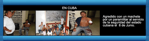 CUBA FOTORREPORTAJE: Werlando Leyva Batista, Miembro del Movimiento Cristiano Liberación, en la zona campesina La Yuraguana, cercano al poblado de San Andrés, provincia Holguín, fue agredido con un machete por un paramilitar al servicio de la seguridad. web/folder.asp?folderID=136 