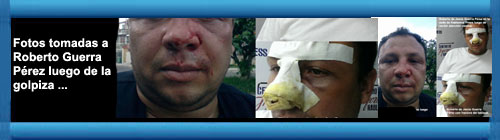 CUBA REPRESIN: Fotos tomadas a Roberto de Jess Guerra Prez luego de la golpiza. http://www.cubademocraciayvida.org/web/folder.asp?folderID=136   