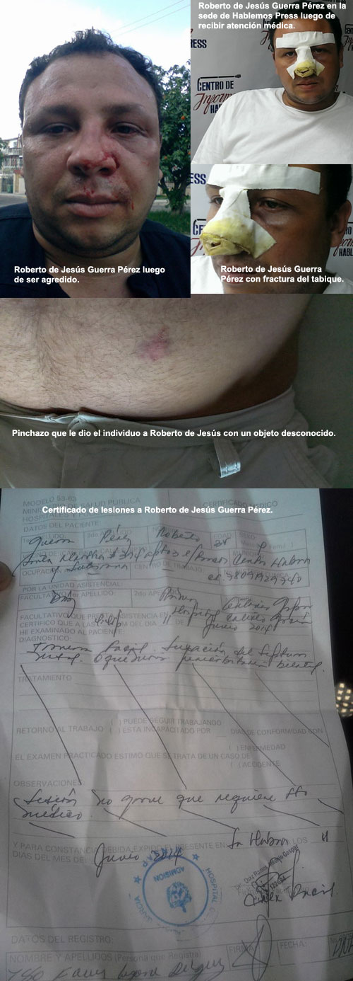 CUBA REPRESIN: Fotos tomadas a Roberto de Jess Guerra Prez luego de la golpiza. http://www.cubademocraciayvida.org/web/folder.asp?folderID=136